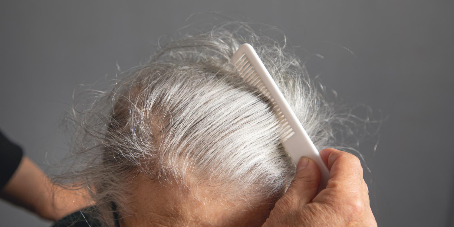 Understanding Hair Loss: Chemo, Alopecia & Beyond